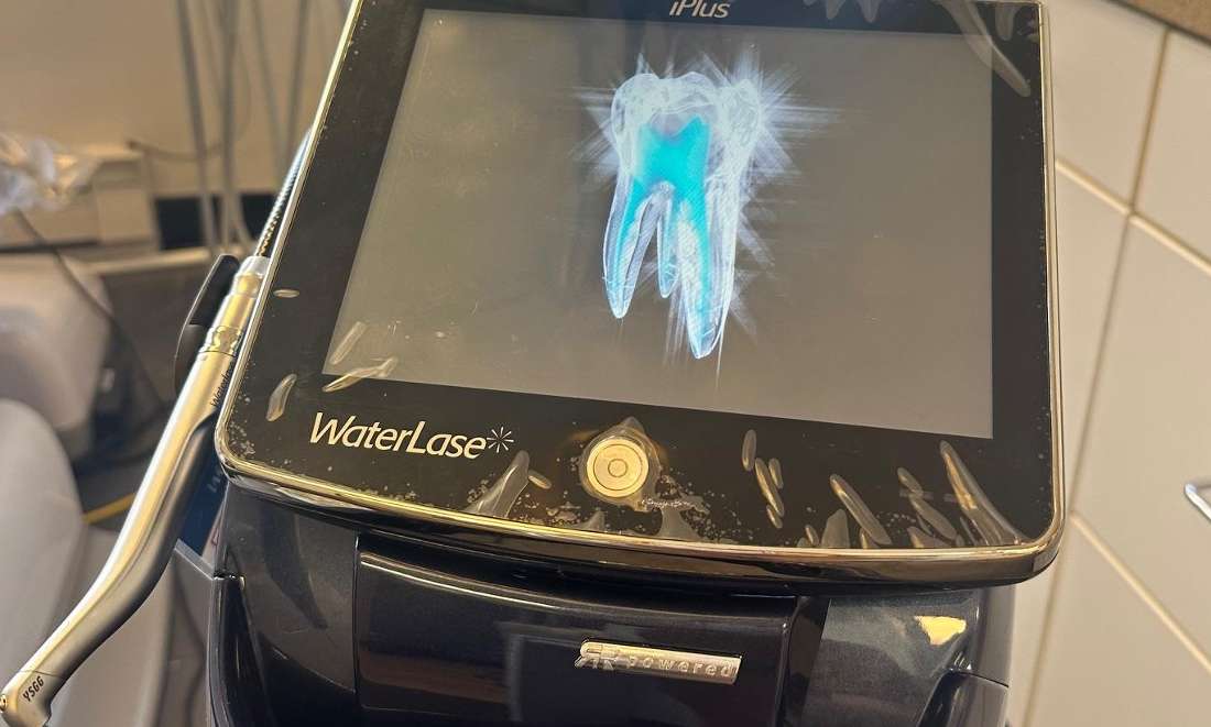 Our latest technology Waterlase Laser